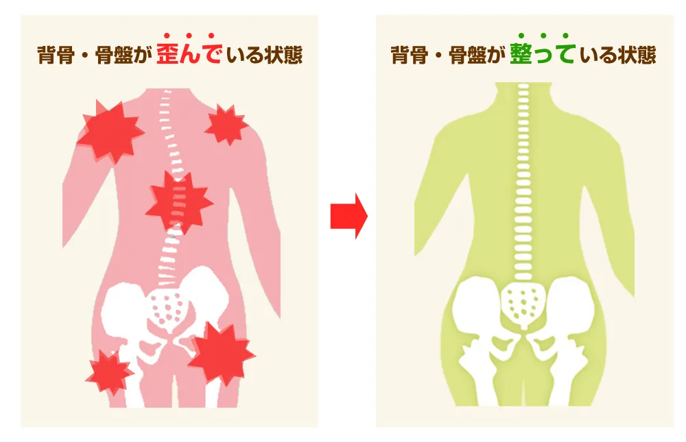 背骨・骨盤がゆがんでいる状態と整っている状態のイラスト